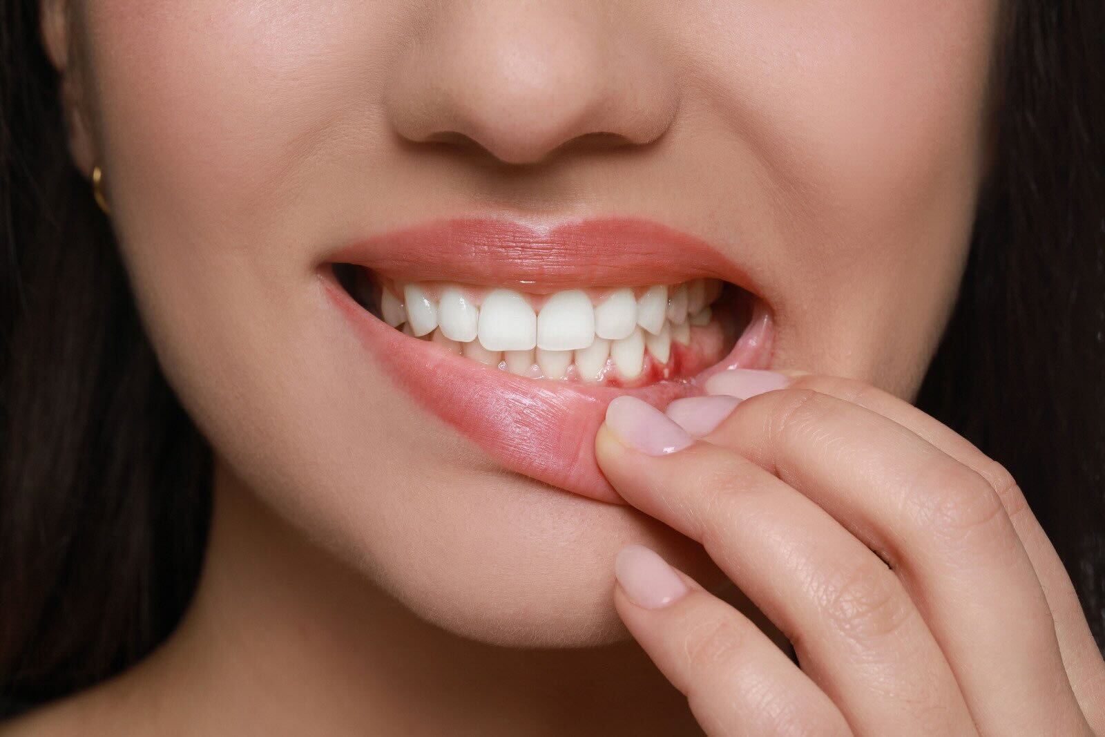 Gum Disease Treatment