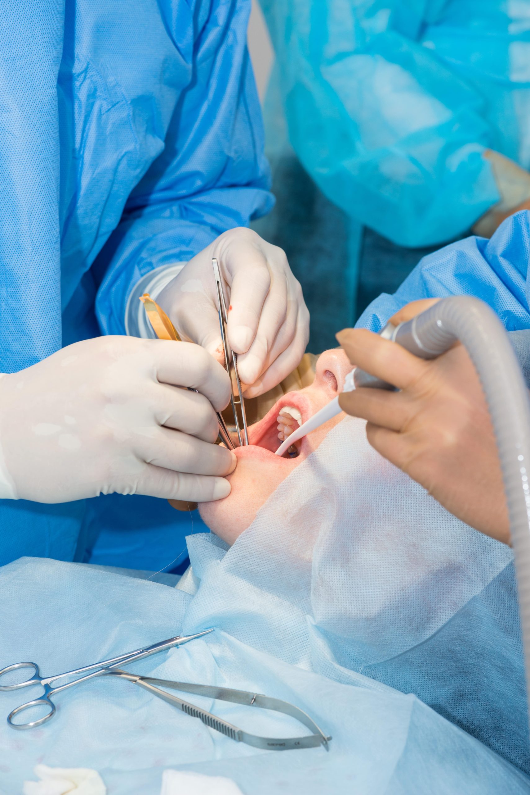 implant surgery
