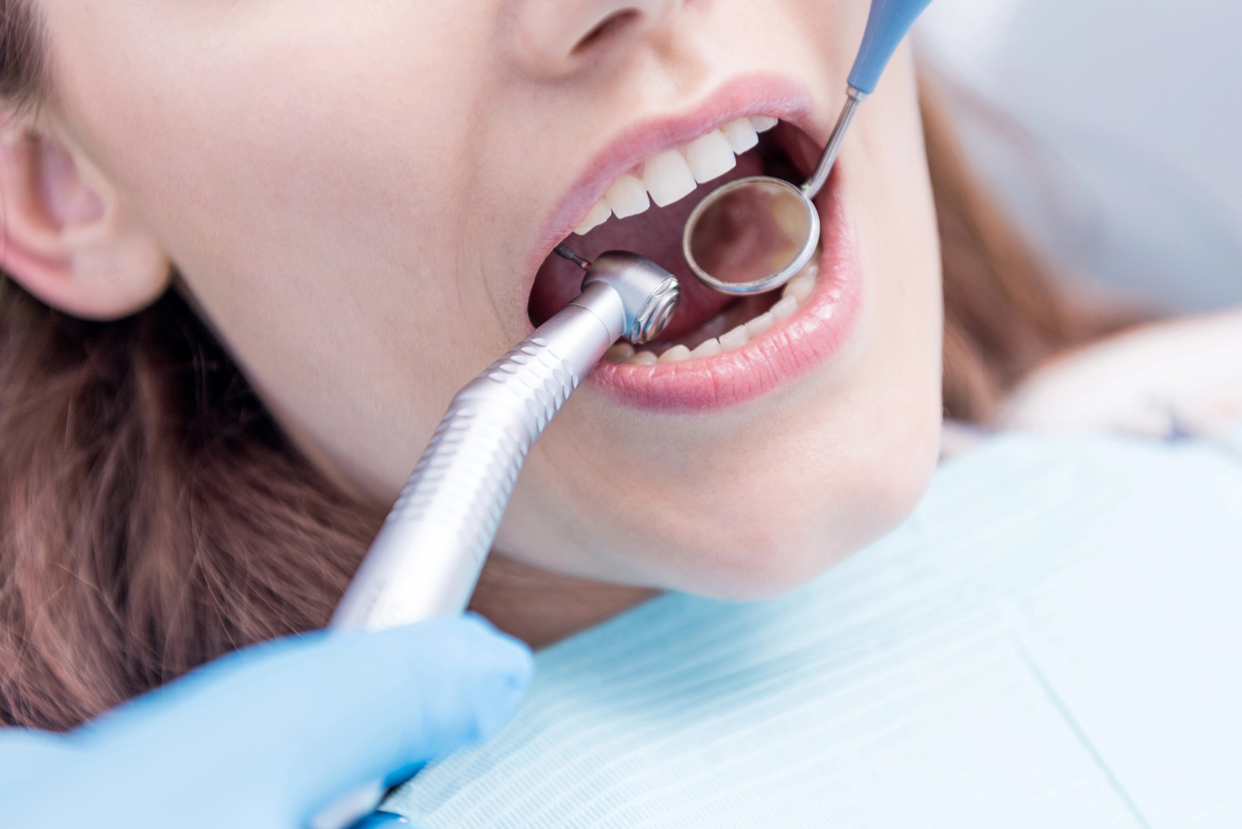 Dental Cleaning and Exam for Adults: Maintaining Oral Health